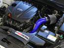 HPS エアインテーク Hyundai Sonata / Kia Optima 2.4L用-2