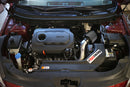 HPS エアインテーク Hyundai Sonata / Kia Optima 2.4L Non Turbo用-4